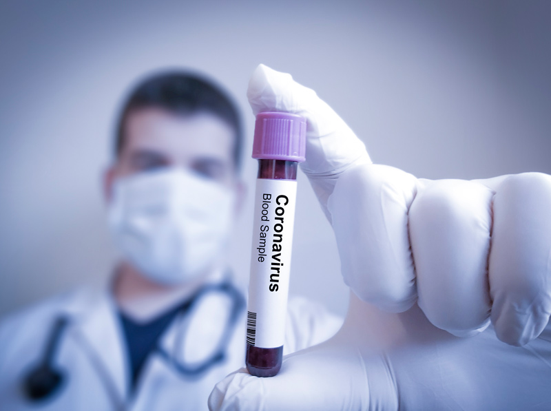 Coronavirus and Wealth: How Safe Are Your Investments?